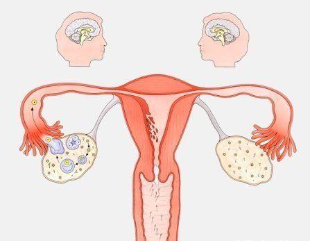 六枝妇女输卵管炎会导致不孕吗